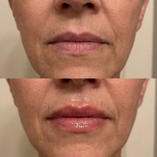 Lips before and after the routine