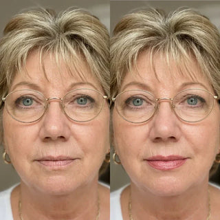 How to Fix Dry Lips: What Really Helps & What to Avoid