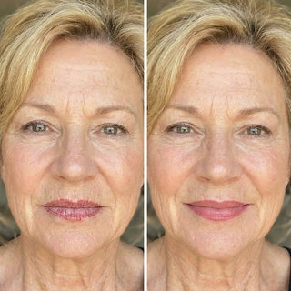 Comparación de hidratación en labios maduros