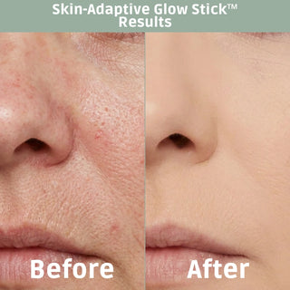 Areliaa Skin-Adaptive Glow Stick