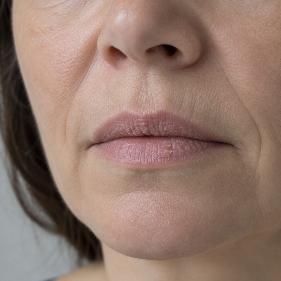 Close-up of lips after 50