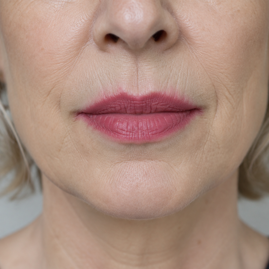Close-up of lips after 50