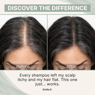 Areliaa Korean Scalp Bar