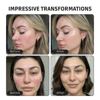 Areliaa 4-in-1 Skin Foundation