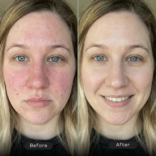 Areliaa 4-in-1 Skin Foundation