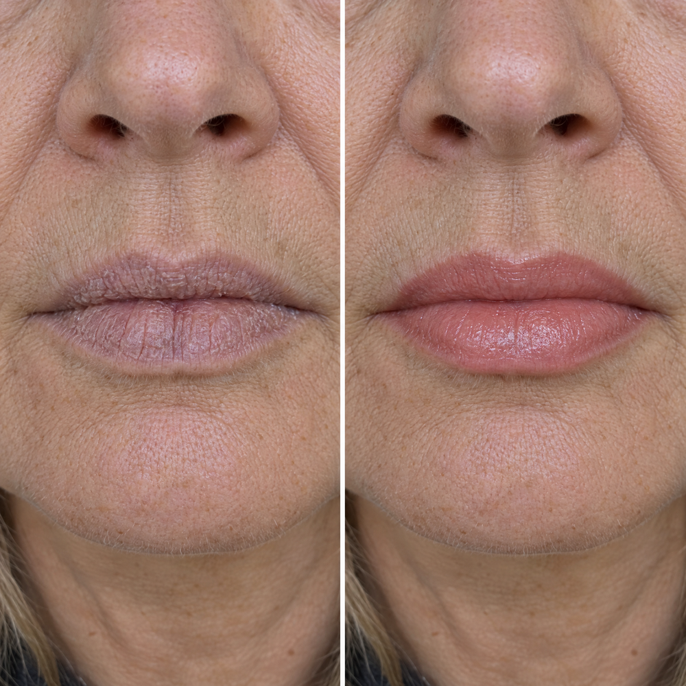 It Protects Against Further Aging