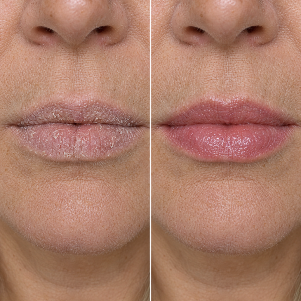It Actually Improves Your Lips Over Time