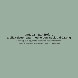GAL-02 · Before (placeholder)