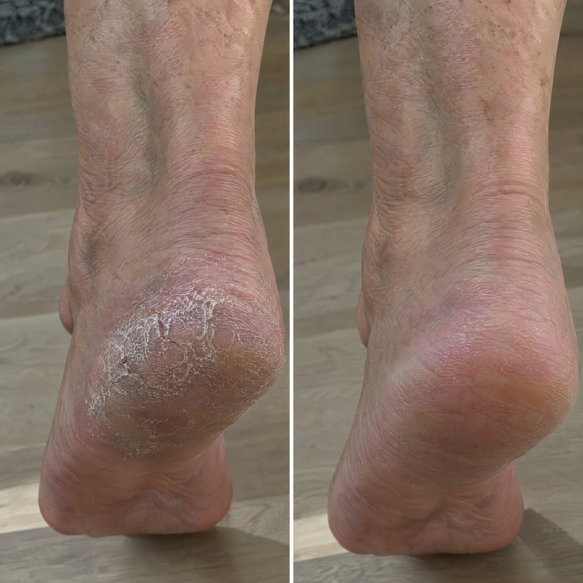 The same heel before and after