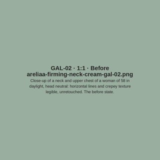 GAL-02 · Before (placeholder)