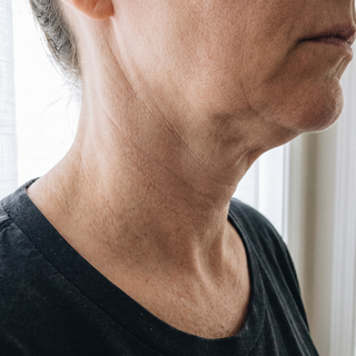 Neck in profile, unretouched