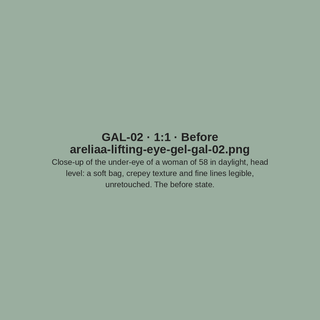GAL-02 · Before (placeholder)